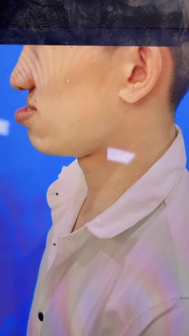 "Ca CHỈNH HÀM nào KHÓ, thì tới ngay KANGNAM!"
